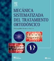 Mecanica En El Tratamiento De Ortodoncia Y La Aparatologia De Arco Recto