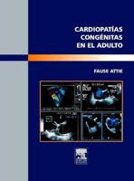 Cardiopatias Congenitas En El Adulto