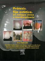 Mallat Callís, E: Prótesis fija estética : un enfoque clínic