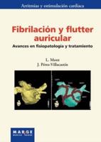 Fibrilación Y Flutter Auricular