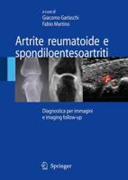 Artrite reumatoide e spondiloentesoartriti : Diagnostica per immagini ed imaging follow-up