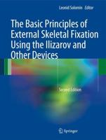 The Basic Principles of External Skeletal Fixation Using Ilizarov and Other Devices