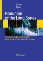 Nonunion of the Long Bones : Diagnosis and treatment with compression-distraction techniques