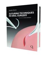 Suturing Techniques in Oral Surgery