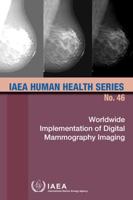 Worldwide Implementation of Digital Mammography Imaging