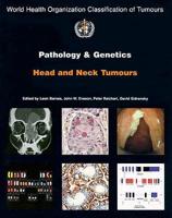 Pathology and Genetics of Head and Neck Tumours