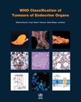 WHO Classification of Tumours of Endocrine Organs. 4TH ED