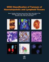 WHO Classification of Tumours, Volume 2 Classification of Tumours of Haematopoietic and Lymphoid Tissues