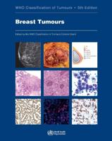 World Health Organization Classification of Tumours 2. WHO Classification of Tumours of the Breast