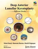 Deep Anterior Lamellar Keratoplasty