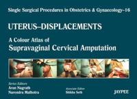 Uterus - Displacements