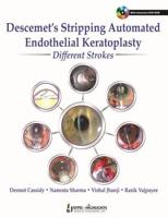 Descemet's Stripping Automated Endothelial Keratoplasty: Different Strokes