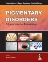 Pigmentary Disorders