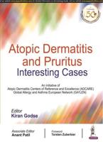 Atopic Dermatitis and Pruritus-Interesting Cases