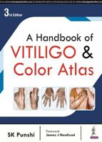 A Handbook of Vitiligo & Color Atlas