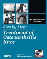 Step by Step Treatment of Osteoarthritis Knee