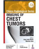 Imaging of Chest Tumors