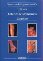 Ictiosis - Estados Ictiosiformes