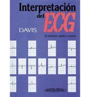 Interpetracion del ECG