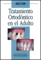 Tratamiento Ortodontico En El Adulto