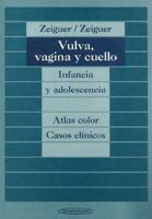 Vulva Vagina y Cuello