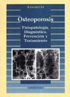 Osteoporosis