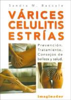 Varices Celulitis Estrias / Varix Cellulite Strias