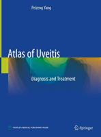 Atlas of Uveitis