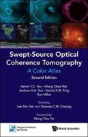 Swept-Source Optical Coherence Tomography: A Color Atlas (Second Edition)