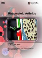 Rheumatoid Arthritis