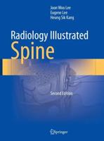 Radiology Illustrated. Spine