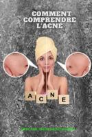 Comment Comprendre L'acné