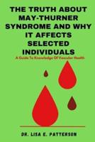 The Truth About May-Thurner Syndrome And Why It Affects Selected Individuals