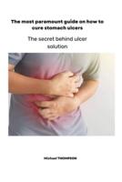The most paramount guide on how to cure stomach ulcers:   The secret behind ulcer solution