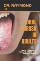 Oral Thrush in Adults