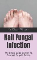 Nail Fungal Infection  : The Simple Guide On How To Cure Nail Fungal Infection
