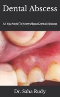 Dental Abscess :  All You Need To Know About Dental Abscess