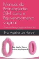 Manual De Perineoplastia SEM Corte E Rejuvenescimento Vaginal