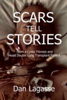 Scars Tell Stories