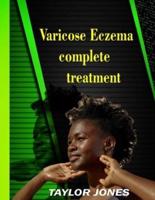 Varicose Eczema Complete Treatment