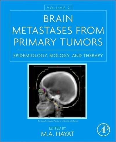 Brain Metastases from Primary Tumors Volume 2