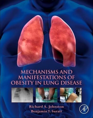 Mechanisms and Manifestations of Obesity in Lung Disease