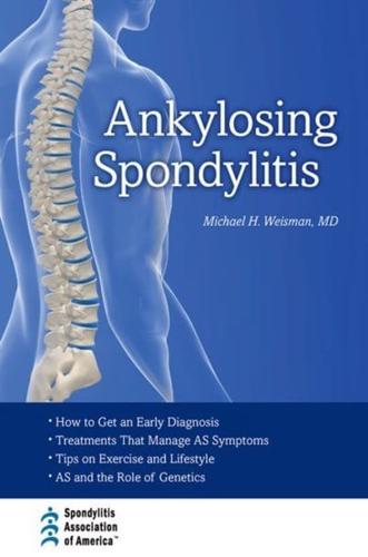 ANKYLOSING SPONDYLITIS C