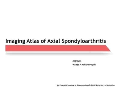 Imaging Atlas of Axial Spondyloarthritis