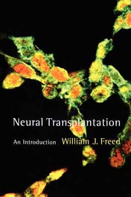 Neural Transplantation - An Introduction
