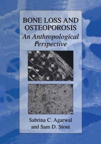 Bone Loss and Osteoporosis