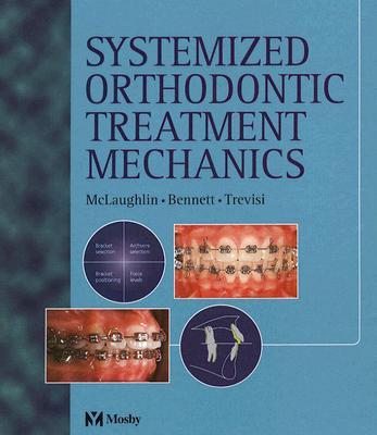 Systemized Orthodontic Treatment Mechanics