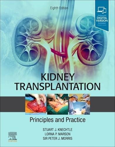 Kidney Transplantation