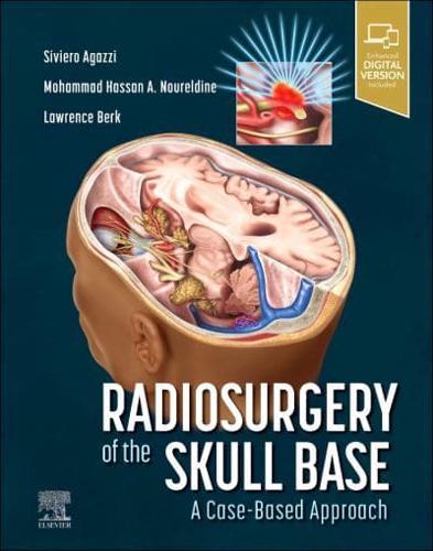 Radiosurgery of the Skull Base