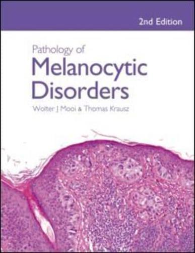 Pathology of Melanocytic Disorders